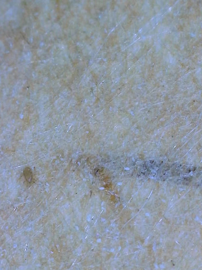 Trombiculaphagus gegen Grasmilben - mit Erfolgsgarantie